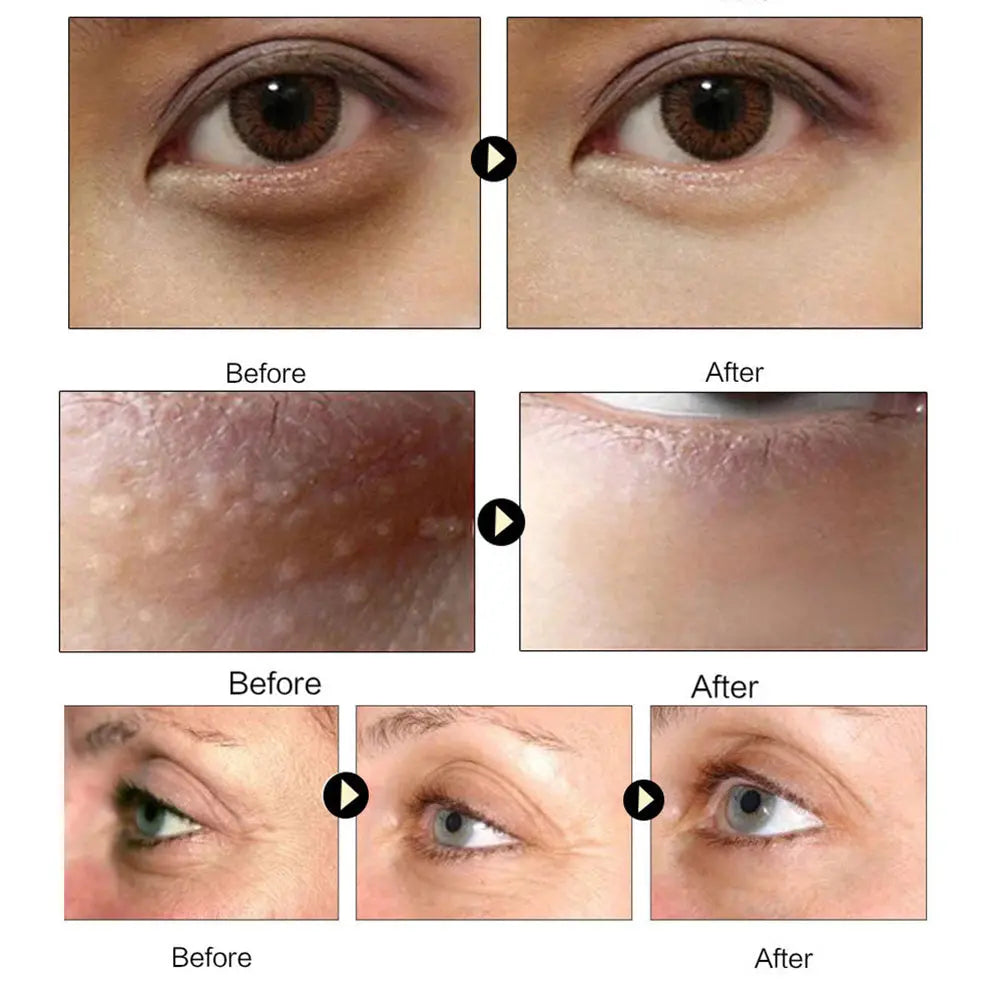 Gold Collagen Eye Mask El Pazar